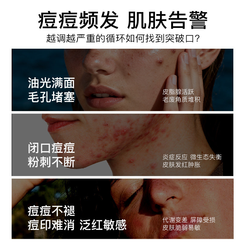Herbsense贺柏圣锌修护片内调维B姜黄素补锌控油青春痘粉刺痘印