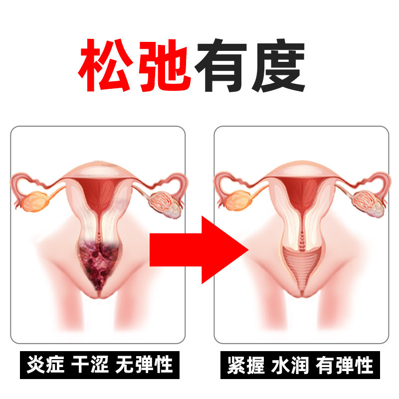 妇科抑菌凝胶正品私处护理苦参 康健医疗器械专营私处护理