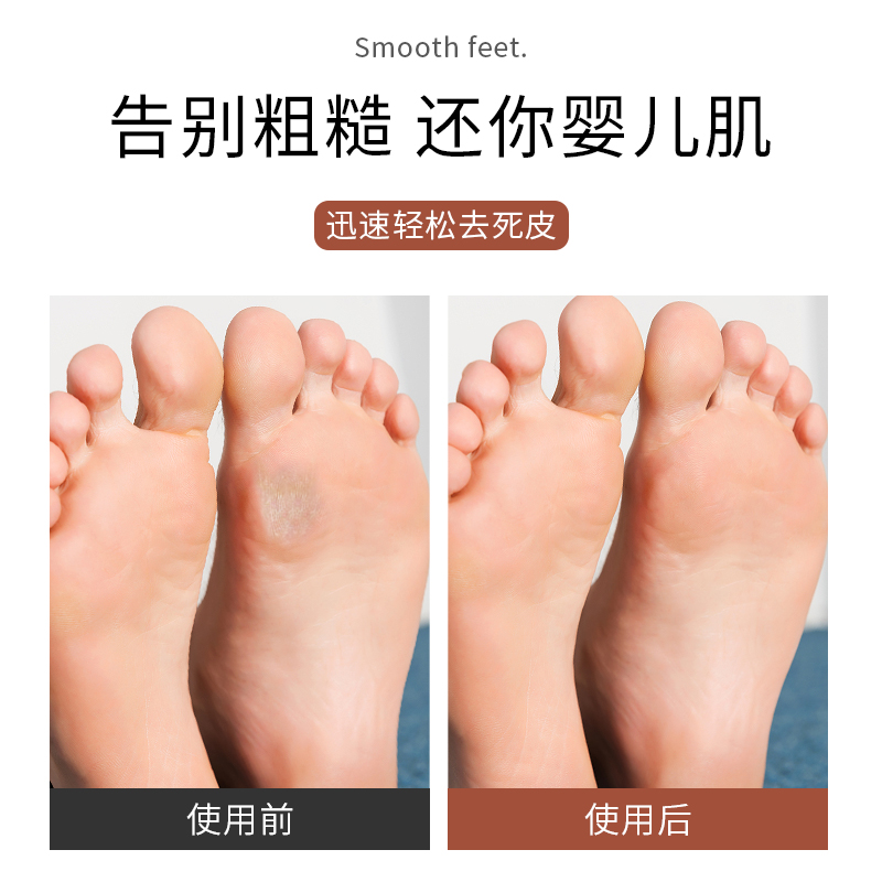 去死皮磨脚神器女士不伤脚刮脚后跟老茧家用修脚工具搓脚板磨脚石