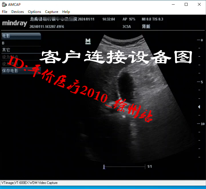 维真VT-600EX PCI-E 视频采集卡 超声工作站软件内镜 正品包邮 - 图2