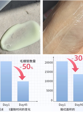 ACM爱诗魅舒颜面霜 舒缓烂脸泛红 闭口痘痘肌 屏障受损红血丝