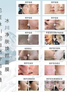 三代ICE GROUND加拿大冰川泥面膜 调节油脂控油闭口疏通毛孔清洁