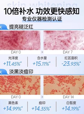 央ma推荐补水美白套装热销30万