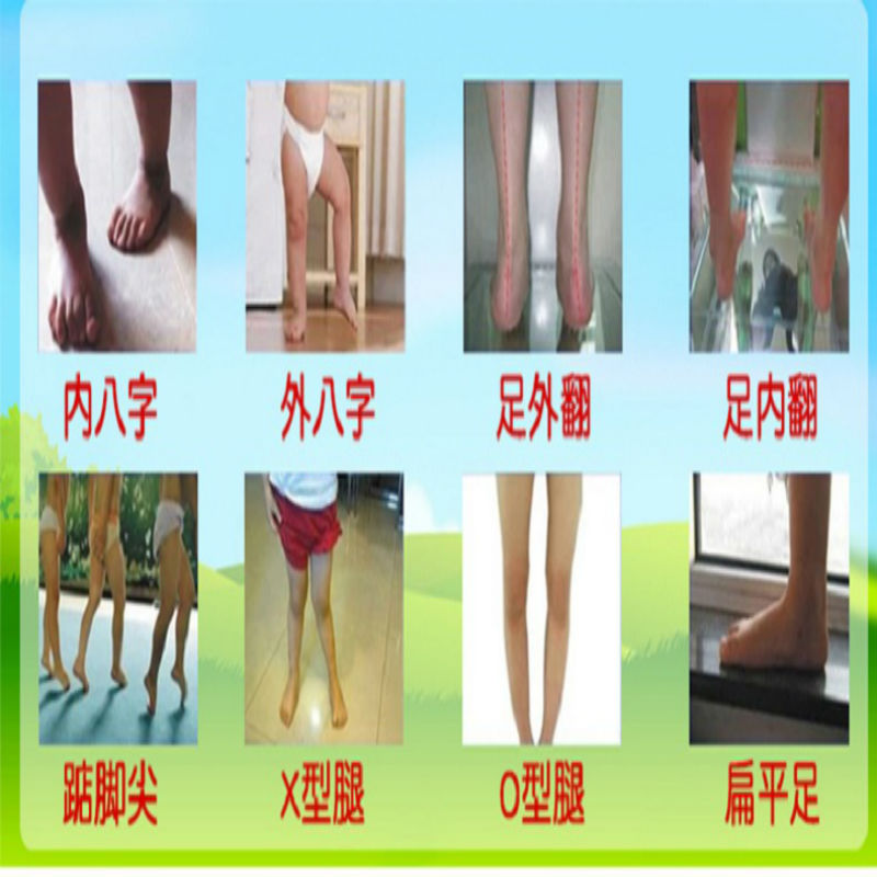 儿童内八字矫正鞋垫x型腿足外翻踮脚走路 马蹄