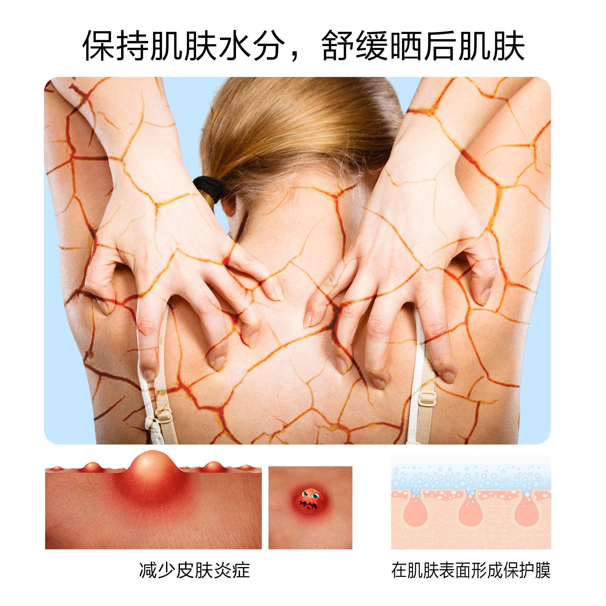 特必达痘必达冷敷理疗膜修护膜肌肤 沃派尔医疗器械冷热敷器具（器械）