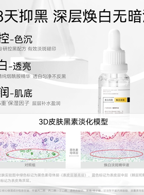 美白祛斑淡化痘印提亮肤色