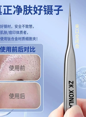 小天籁眉夹小镊子高精密拔毛钳子