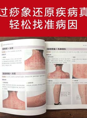 零基础学刮痧图解痧象书刮痧书刮痧板刮痧入门书常见病刮痧教程如