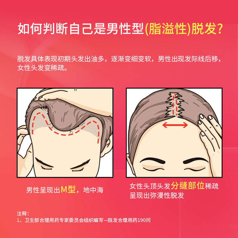 蔓迪米诺地尔酊防脱发【蔓迪礼盒】 蔓迪白发脱发