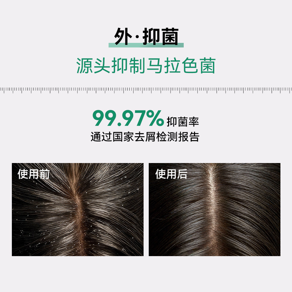 蔓迪二硫化硒去屑洗发水控油止痒洗发液洗头水0.5%不伤头皮非洗剂