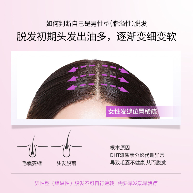 蔓迪米诺地尔酊女性防脱发 蔓迪白发脱发