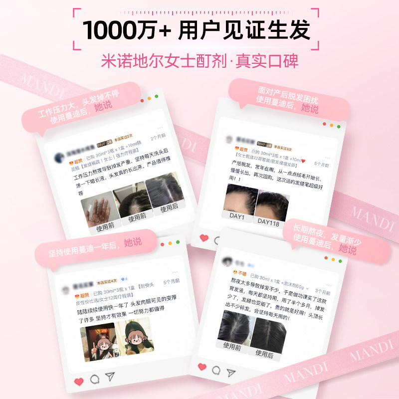蔓迪米诺地尔酊男女性防脱生发液增发密发育发正品搭上药器洗发水