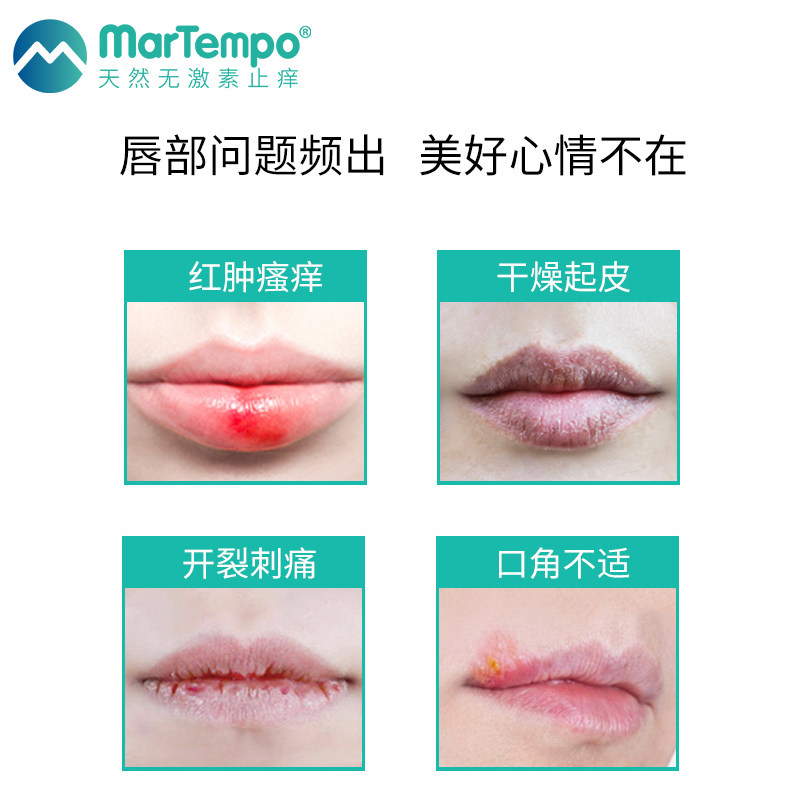 【皮肤科医生推荐】海得宝唇部凝胶 martempo海得宝宝宝护唇/润唇