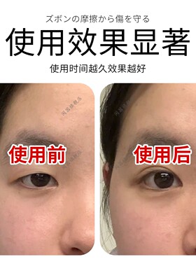 眼皮下垂提拉眼贴上拉定型紧致眼袋贴消除脂肪眼皱纹贴淡纹神器