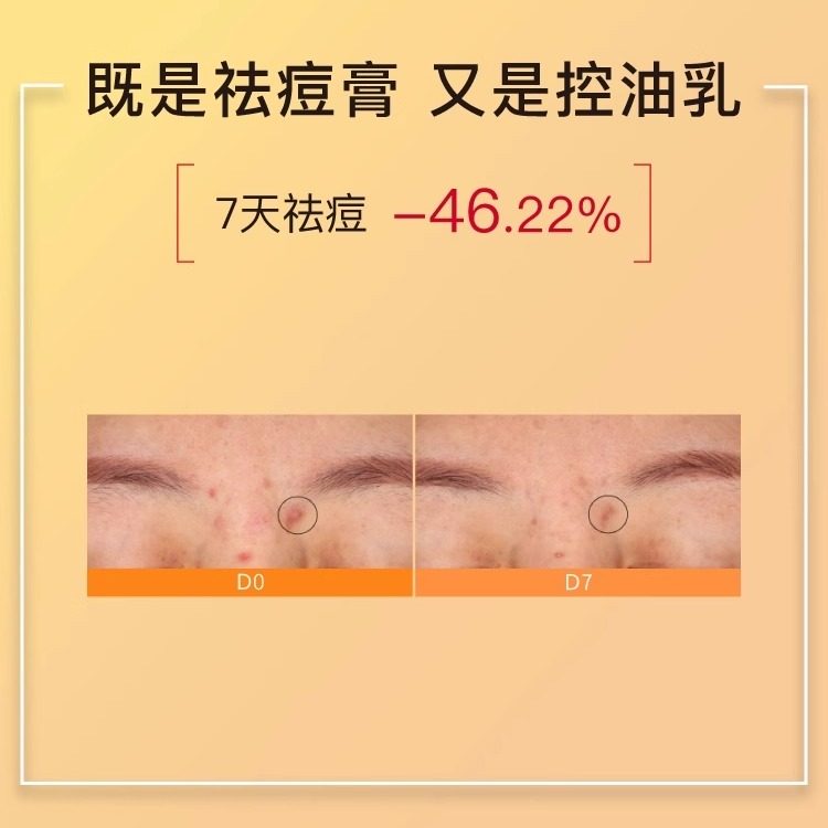 【专柜正品】John Jeff20%壬二酸霜15ml - 图2