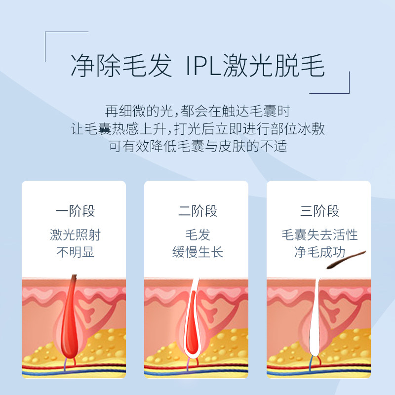 冰点脱毛仪器腋毛剃毛器家用脱毛仪冰点激光脱毛仪脱毛器