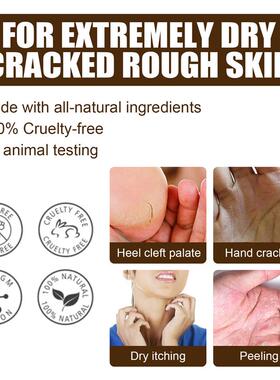 Foot Repair Healing cream for Cracked Heels and Dry Feet足霜