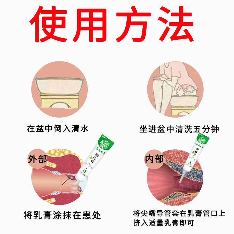 云南本草痔疮膏痔根断痔疮去肉球消肉球男女性凝胶神器药膏正品-图2