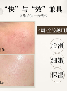 OT蓝铜抗皱紧致毛孔精华液