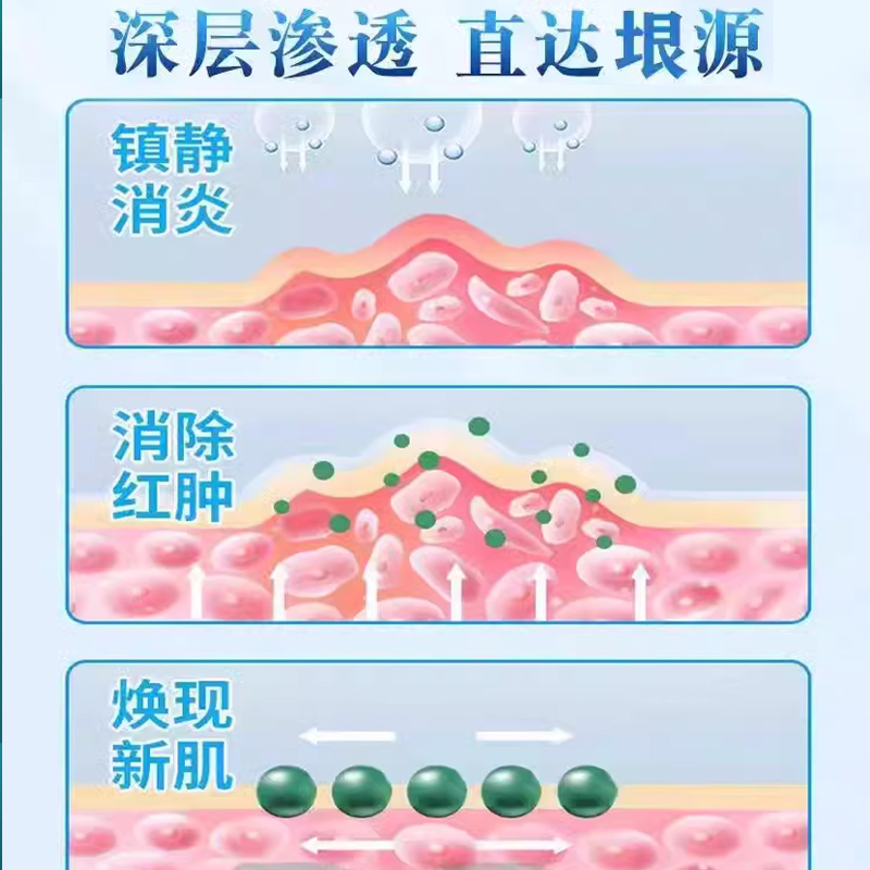 脂溢性皮炎鼻翼眉间头上鼻子两侧发红脱皮两边泛红干燥起皮面霜TU - 图2