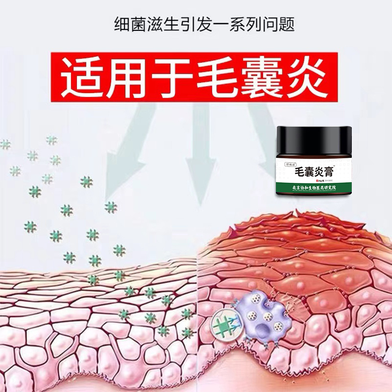 手臂毛囊炎胳膊上的长小疙瘩毛孔堵塞疏通毛囊去鸡皮肤磨砂膏VQ - 图1