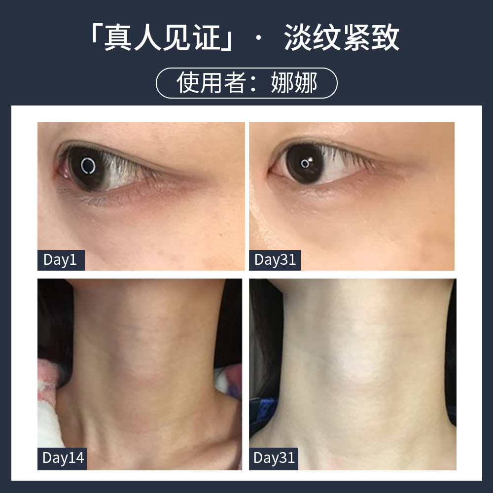 ble de fonty枫缇黑安瓶胜肽淡眼霜 枫缇眼部精华