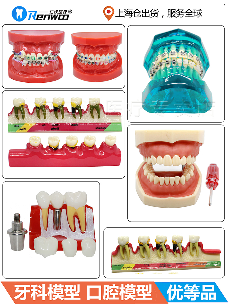 牙齿模型 口腔模型 牙科标准牙模 牙模型 教学假牙带神经医患沟通 - 图3
