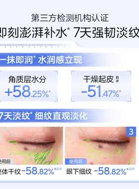 欧诗漫水活套装水乳补水保湿滋润