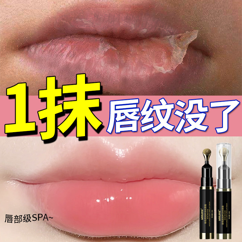 唇部精华小熨斗淡化唇纹去死皮唇霜 芙优植唇部精华