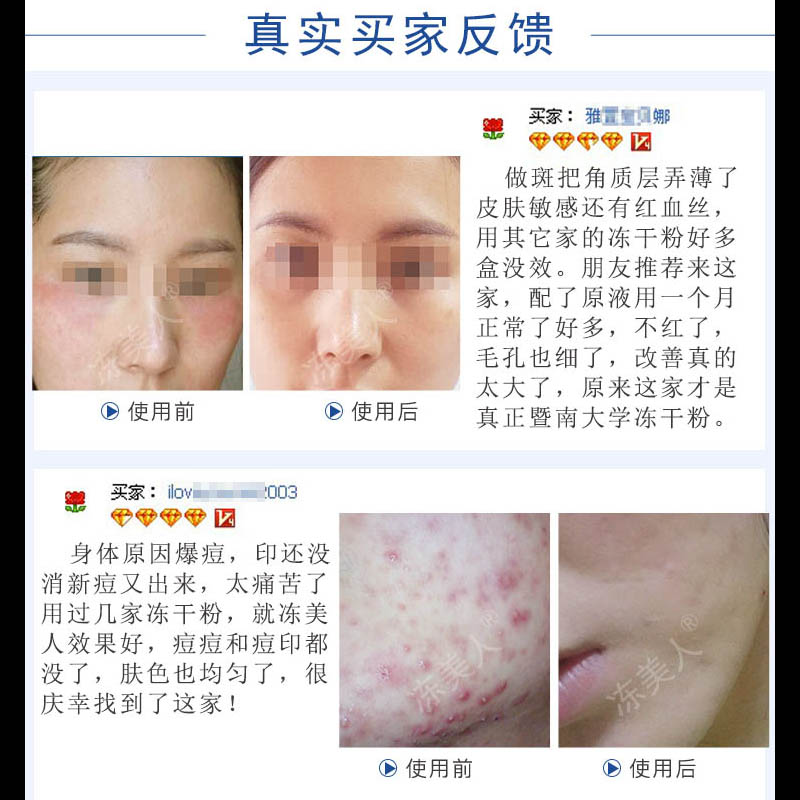 暨大冻干粉旗舰店官方正品去痘印修复红血丝精华寡肽原液收缩毛孔 - 图2