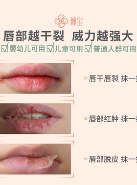 棘宝沙棘膏滋润唇膏男女木瓜膏保湿补水宝宝婴儿童学生秋冬护唇膏