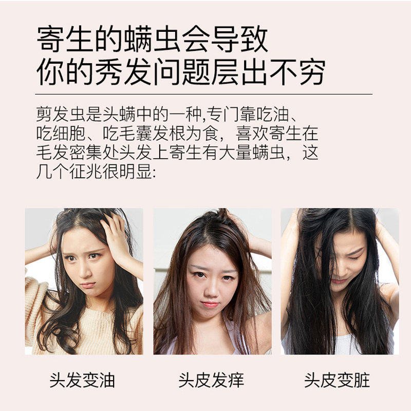 满婷除螨男女士身体后背部沐浴露 泰尊家居香皂