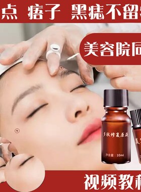 点斑水点雀斑水脸部祛遗传斑老年斑黑痣痦子药水无痕正品美容金水