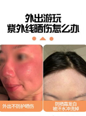 颧骨防晒贴户外运动夏季海边紫外线物理脸部眼角痣斑术后透气防水