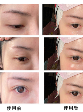 美国Sundari洋甘菊眼油眼部精油精华油淡化黑眼圈眼袋10ml淡细纹