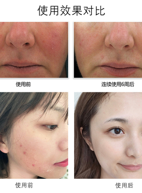Topix replenix 绿茶多酚咖啡因精华30ml cf高纯度舒缓