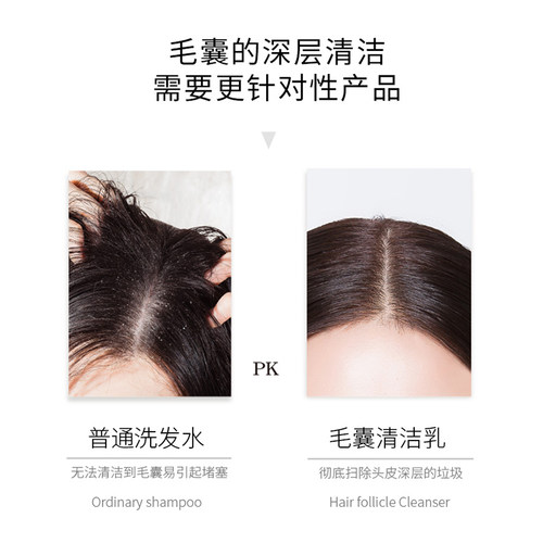 capilo卡彼超级控油去屑套装疗程 - 图1