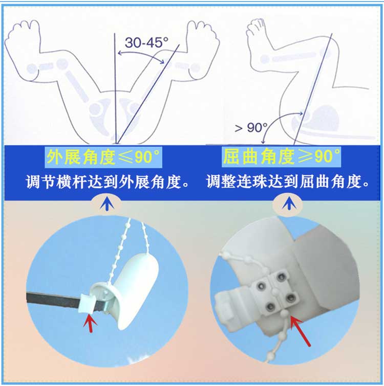 髋关节外展支具儿童蛙式架髋关节发育不良矫形器髋关节不对称固定 - 图1