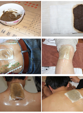 腰间盘坐骨神经腰椎颈椎肩周关节