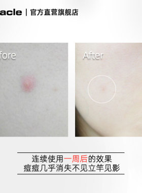 Ciracle稀拉克儿升级粉色祛痘修护液2ml水杨酸小粉瓶粉刺闭口
