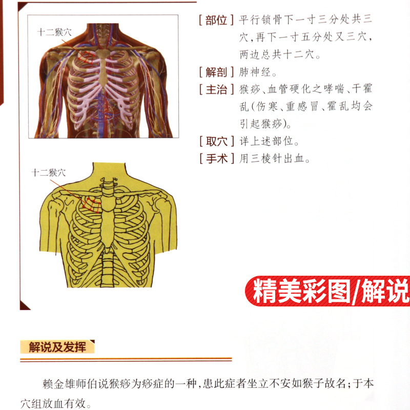 董氏奇穴 人卫版 针灸学全集 董氏学位速查大全 董氏奇穴针灸学董氏奇穴书籍董氏针灸书 邱雅昌著 二版 2 第 董氏正经奇穴实用手册 董氏奇穴 人卫版 针灸学全集 董氏学位速查大全 董氏奇穴针灸学董氏奇穴书籍董氏针灸书 邱雅昌著 二版 2 第 董氏正经奇穴实用手册