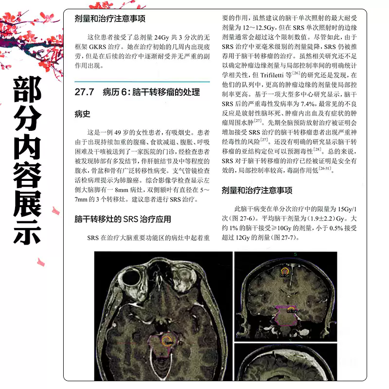 中枢神经系统转移性肿瘤 罗翰 罗摩克里希纳 等主编 王裕 斯璐 王汉萍 主译 人民卫生出版社 外科学 肿瘤学 神经肿瘤学 神经学 - 图1