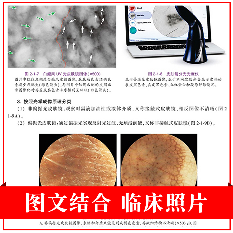 多模态皮肤病医学影像诊断图谱 将用于全国皮肤科医生能力考核的参考书目 孟如松 崔勇主编 9787117311267 人民卫生出版社 - 图1