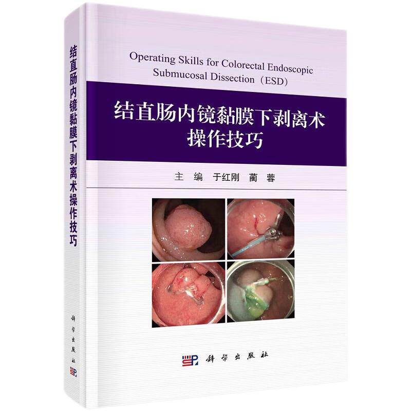 结直肠内镜黏膜下剥离术操作技巧 于红刚 蔺蓉主编 科学出版社 结直肠ESD的基本操作及要点 缺血性结肠炎 护理及麻醉团队的配合