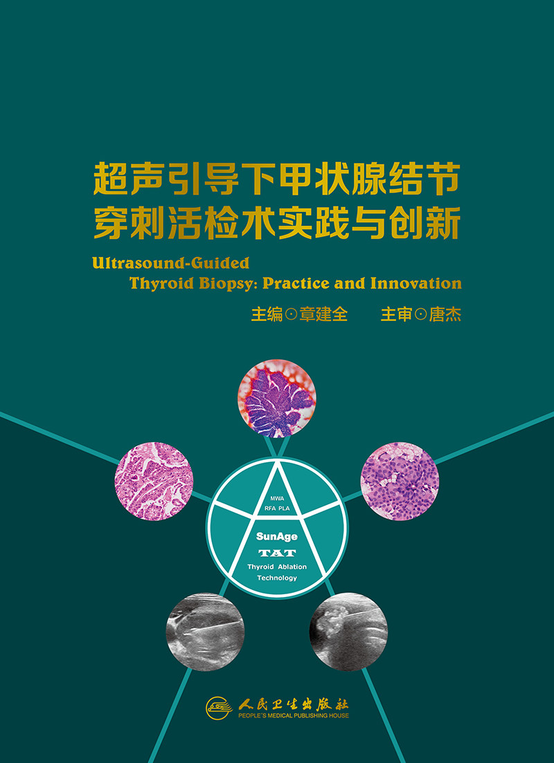 超声引导下甲状腺结节穿刺活检术实践与创新 内容精炼 图片质量高 剖析机制 讲解道理 章建全主编 9787117307536 人民卫生出版社