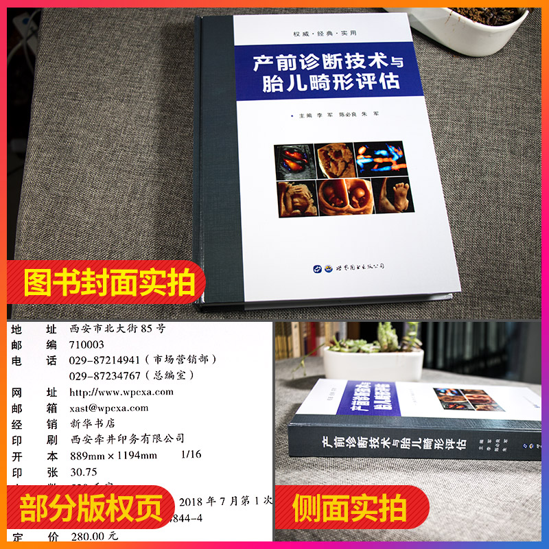 产前诊断技术与胎儿畸形评估 儿畸形产前超声诊断彩图诊断要点产前诊断与产前筛查李军陈bi良朱军 世界图书出版公司 - 图0