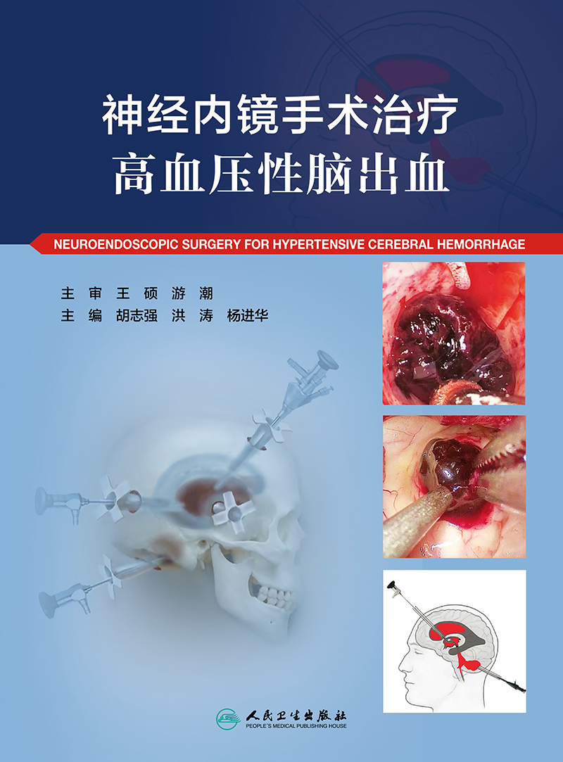 神经内镜手术治疗高血压性脑出血脑出血的相关部位局部解剖诊断与鉴别诊断手术适应症胡志强洪涛杨进华人民卫生出版社-图0