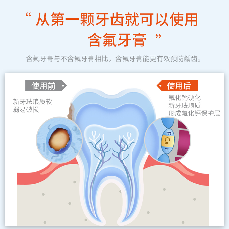 瑞士进口elmex0-1-2-3-6岁儿童防蛀含氟牙膏婴幼儿防龋齿不辣口 - 图1