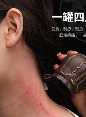 火龙罐肩颈中医莲花口双层艾灸
