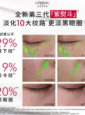 【双11现货不用等】欧莱雅第三代紫熨斗眼霜咖啡因淡化黑眼圈囤货